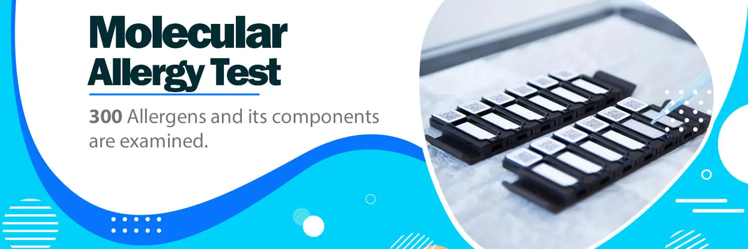 molekuler alerjien
