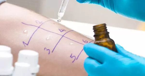 detectable allergies